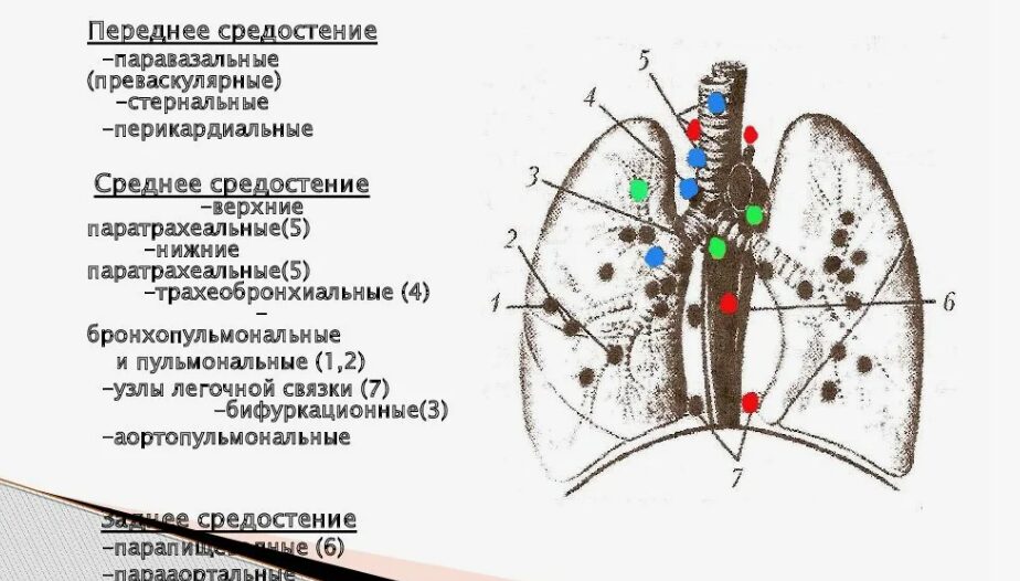 Описание причин Увеличение лимфатических узлов средостения